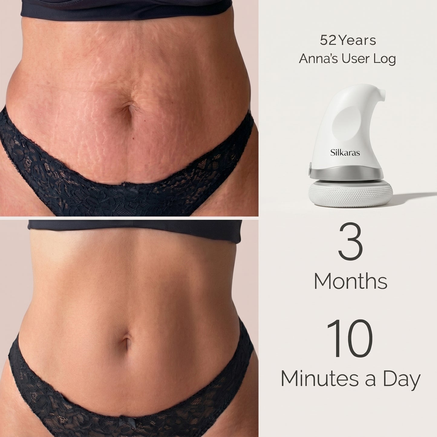 Silkaras 1.0 Body Sculpting Machine
